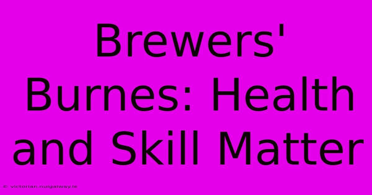 Brewers' Burnes: Health And Skill Matter