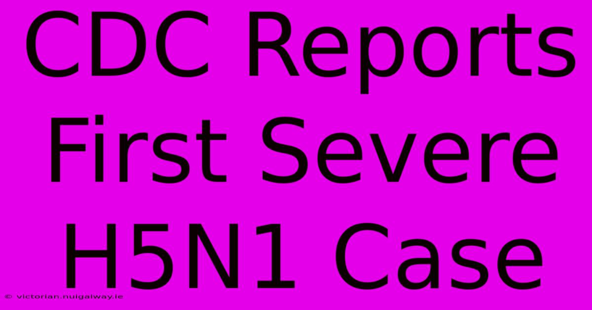 CDC Reports First Severe H5N1 Case