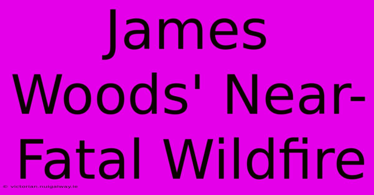 James Woods' Near-Fatal Wildfire