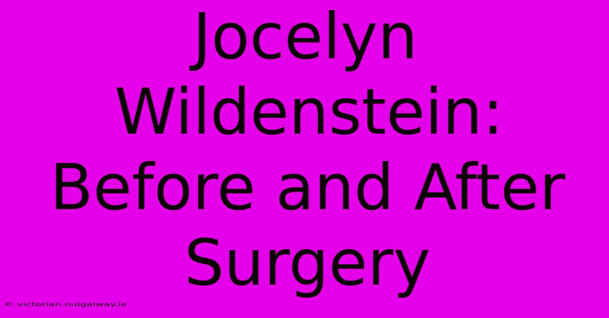 Jocelyn Wildenstein: Before And After Surgery