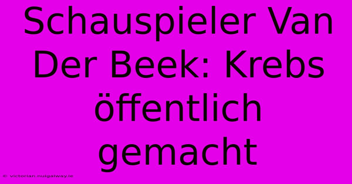 Schauspieler Van Der Beek: Krebs Öffentlich Gemacht 