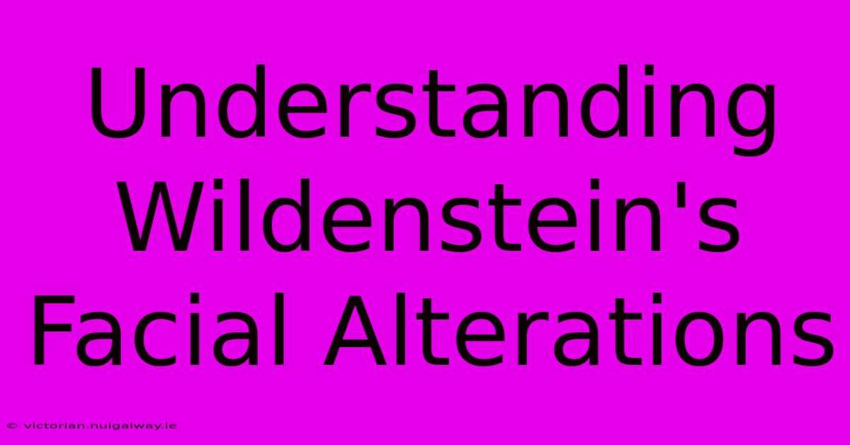 Understanding Wildenstein's Facial Alterations