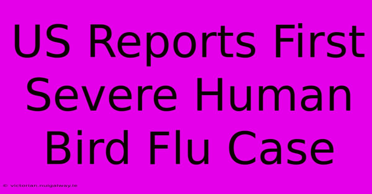 US Reports First Severe Human Bird Flu Case